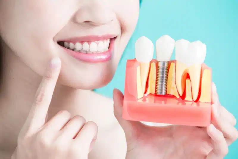 Una mujer sonriente mirando un modelo de cómo funciona un implante dental.