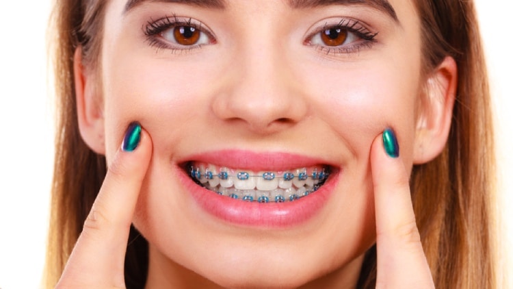 ¿El seguro dental cubre frenos?